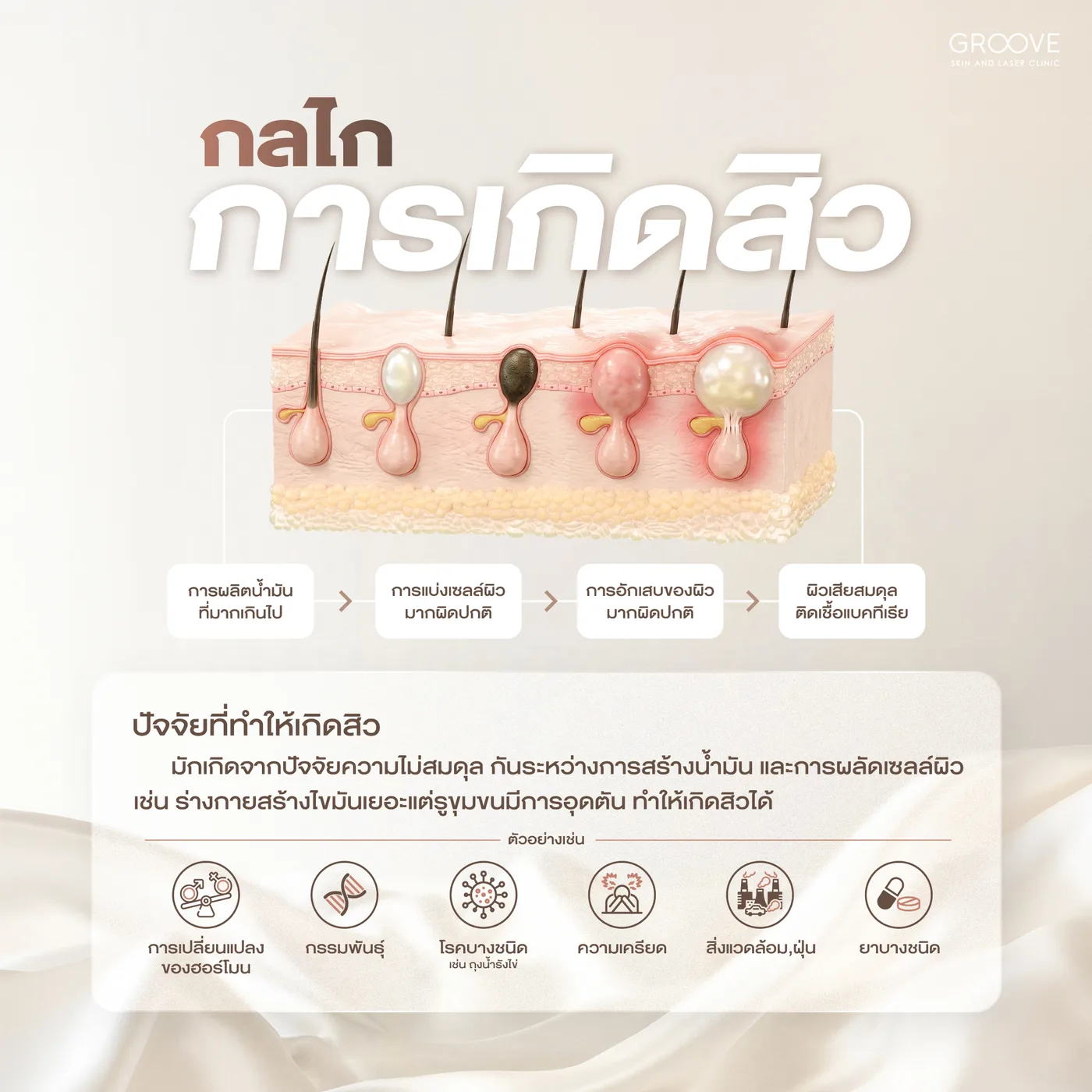 สาเหตุของการเกิดสิว